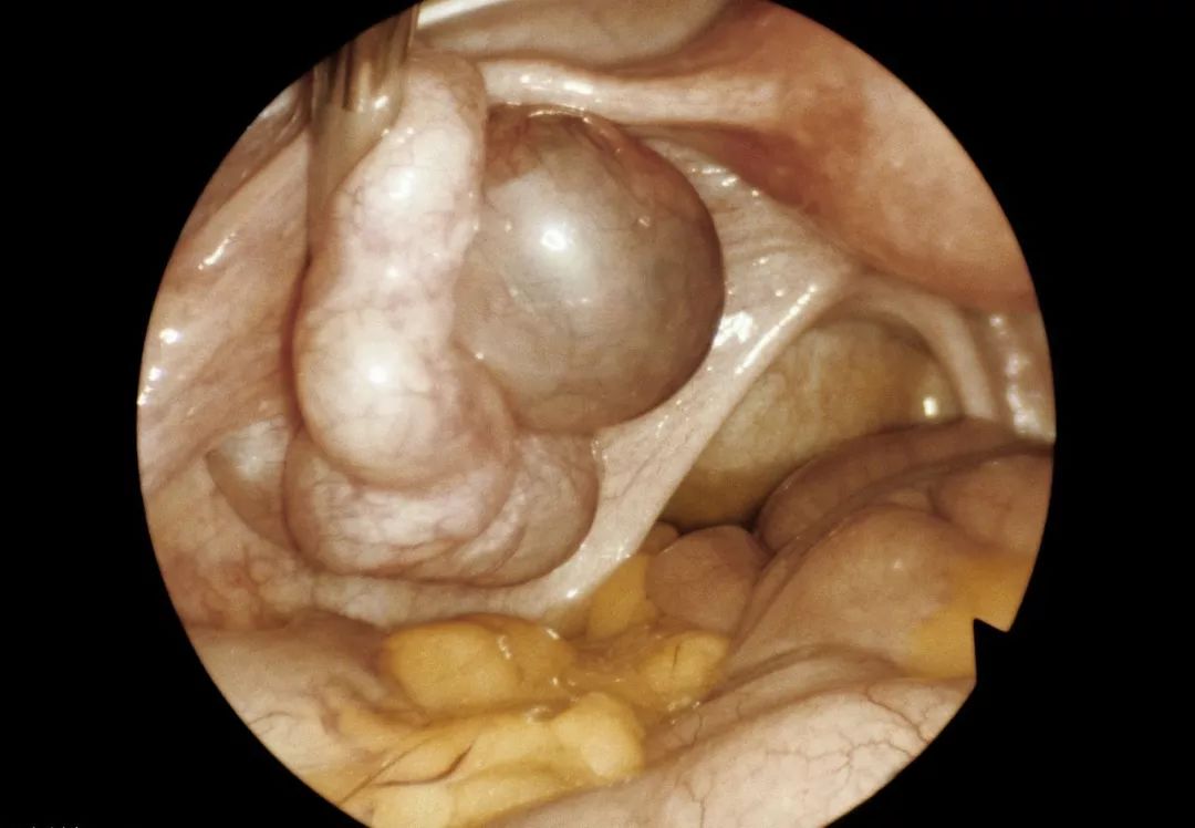 天伦不孕不孕医院_育不孕医院哪家好_不孕不育