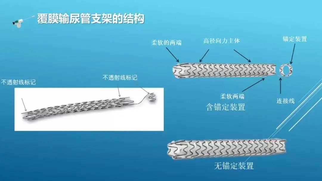 泌尿科_科泌尿外科_甘肃省人民医院泌尿2科