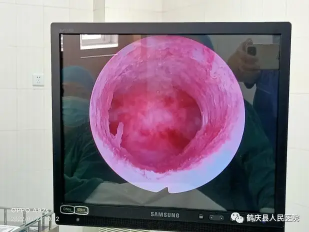 妇科炎症有哪些症状_妇科_妇科医院