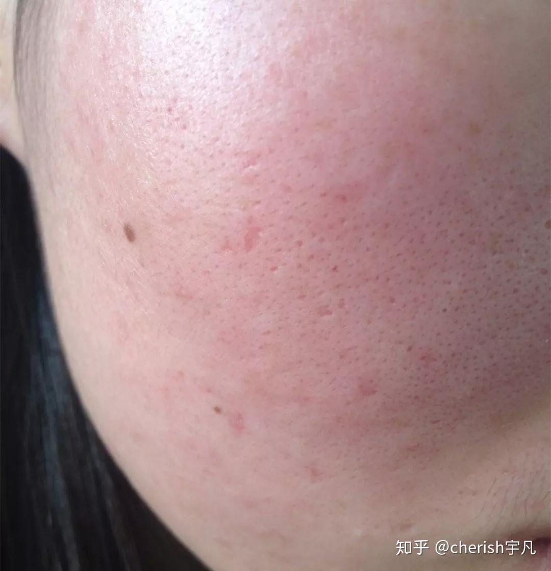 锦囊妙计皮肤出状况?专家教你如何“自救”不知道你注意到没有(图2) 化妆品_化妆品回收_化妆品工厂货源