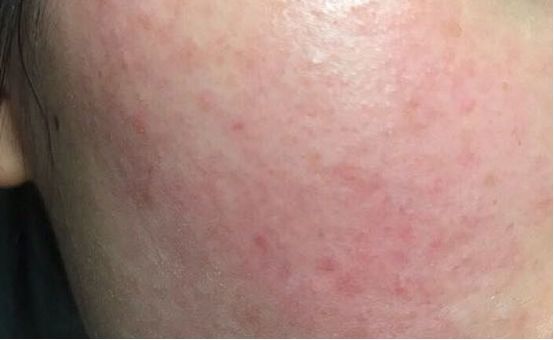 锦囊妙计皮肤出状况?专家教你如何“自救”不知道你注意到没有(图3) 化妆品工厂货源_化妆品_化妆品回收