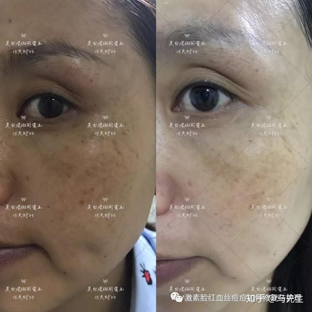 水密码滢亮皙白洁面乳砷含量最高超标(图2) 化妆品_化妆品备案_化妆品工厂货源