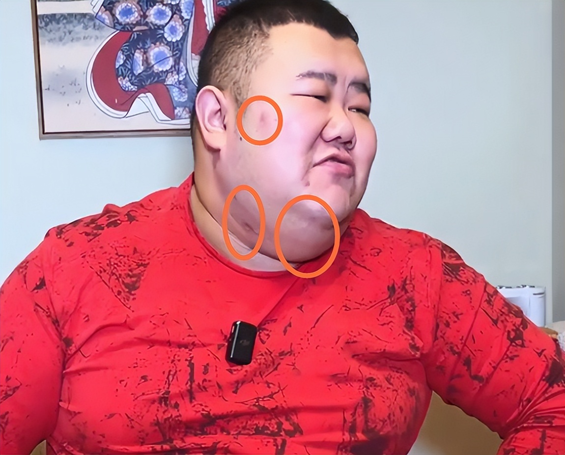 日子好了，人也开始发福了！脖子粗、双下巴预示中心性肥胖！