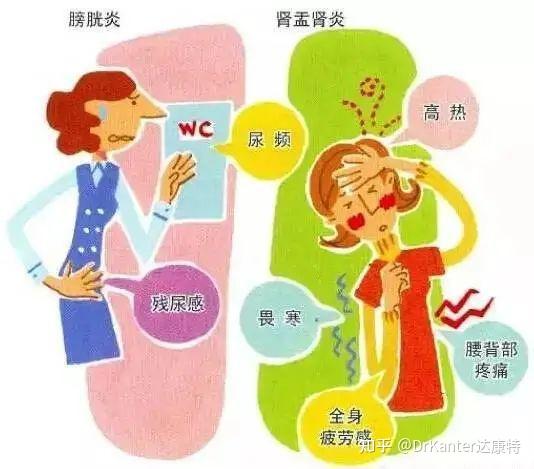 尿液检查：揭示健康秘密，发现潜在疾病的重要指标