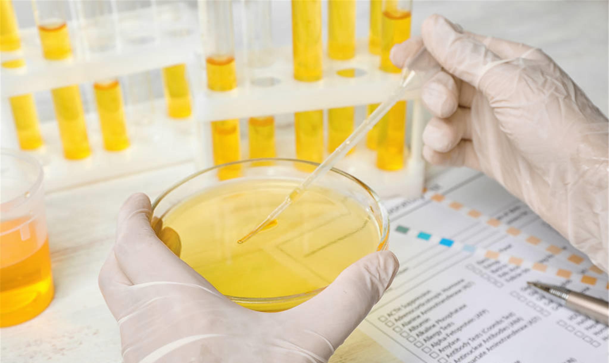 科泌尿科_泌尿科_科泌尿外科