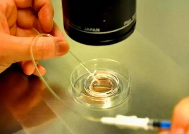 育不孕医院哪家好_不孕不育_天伦不孕不孕医院